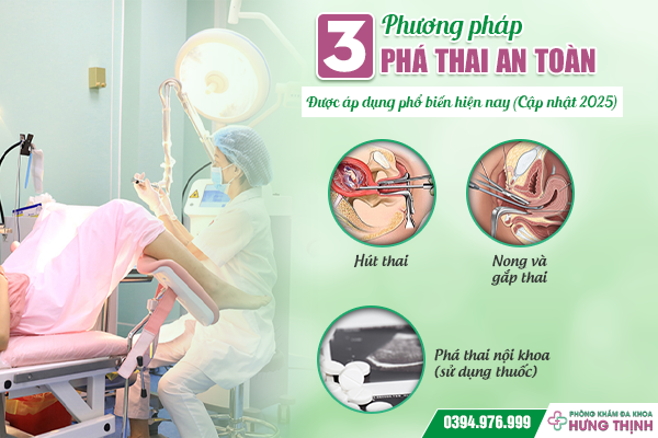3 Phương pháp phá thai an toàn được áp dụng phổ biến hiện nay (Cập nhật 2025)