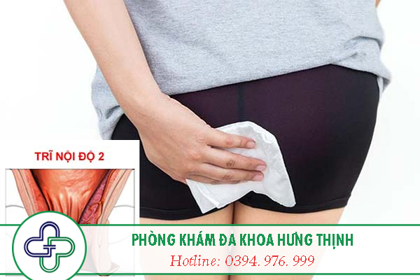 Bệnh trĩ Ngoại là gì - Cách chữa bệnh trĩ ngoại hiệu quả