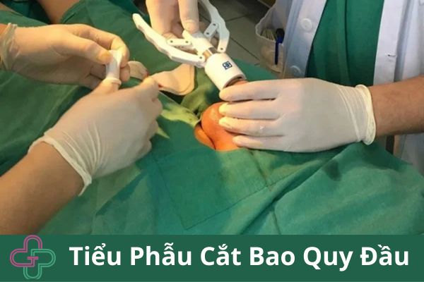 Cắt bao quy đầu: Tất cả những gì bạn cần biết trước khi quyết định