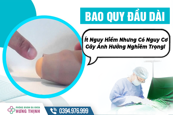 Bao Quy Đầu Dài: Ít Nguy Hiểm Nhưng Có Nguy Cơ Gây Ảnh Hưởng Nghiêm Trọng!