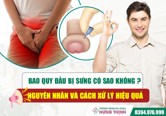 Bao Quy Đầu Bị Sưng Có Sao Không? Nguyên Nhân Và Cách Xử Lý Hiệu Quả