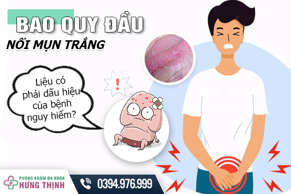 Bao quy đầu nổi mụn trắng - Liệu có phải dấu hiệu của bệnh nguy hiểm?