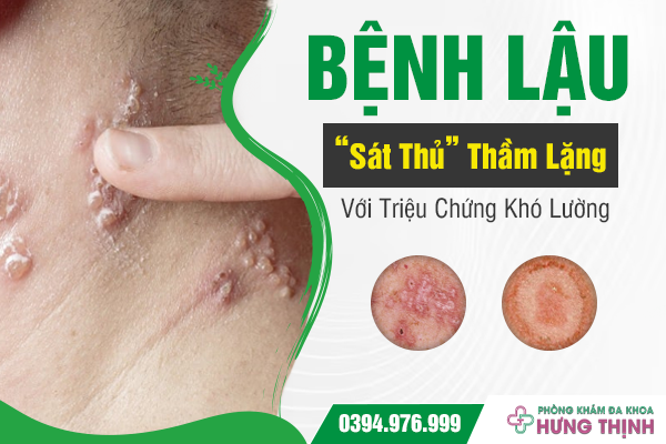 Bệnh Lậu: “Sát Thủ” Thầm Lặng Với Triệu Chứng Khó Lường