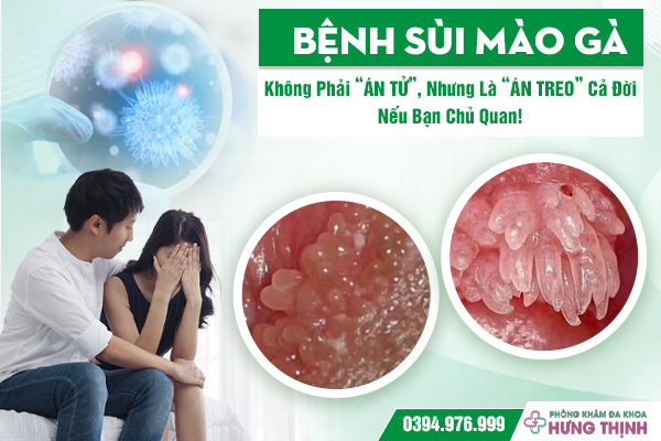 Bệnh Sùi Mào Gà: Không Phải “Án Tử”, Nhưng Là “Án Treo” Cả Đời Nếu Bạn Chủ Quan!
