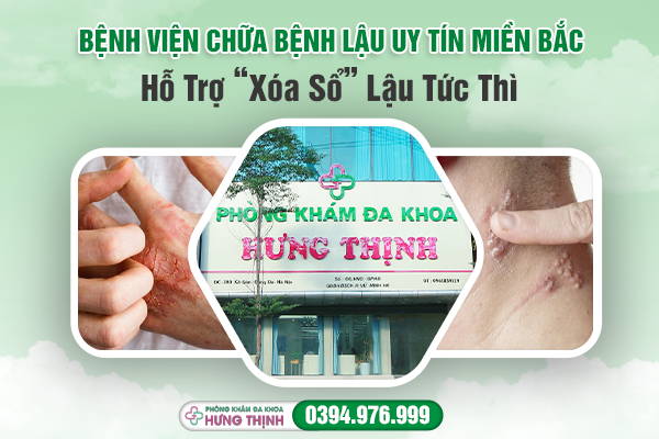 Bệnh Viện Chữa Bệnh Lậu Uy Tín Miền Bắc: Hỗ Trợ “Xóa Sổ” Lậu Tức Thì 