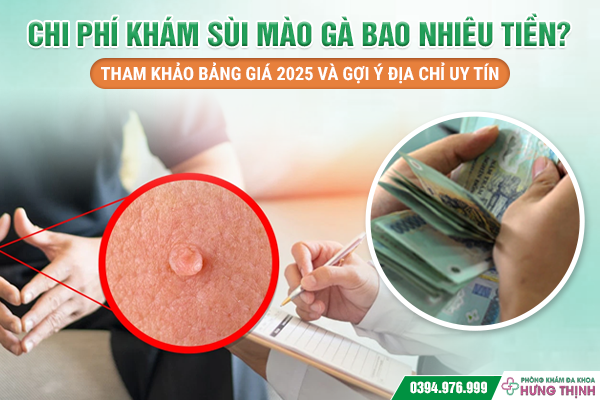 Chi Phí Khám Sùi Mào Gà Bao Nhiêu Tiền? Tham Khảo Bảng Giá 2025 Và Gợi Ý Địa Chỉ Uy Tín