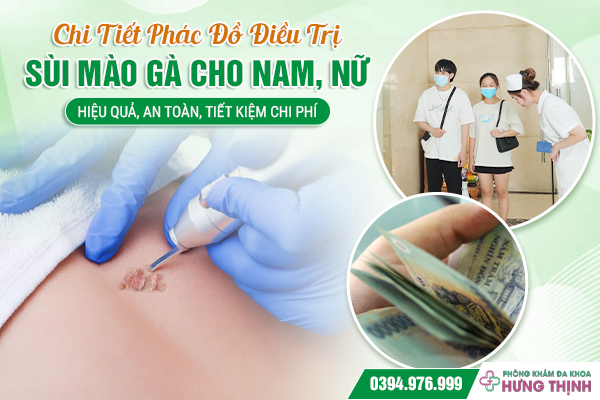 Chi Tiết Phác Đồ Điều Trị Sùi Mào Gà Cho Nam, Nữ: Hiệu Quả, An Toàn, Tiết Kiệm Chi Phí