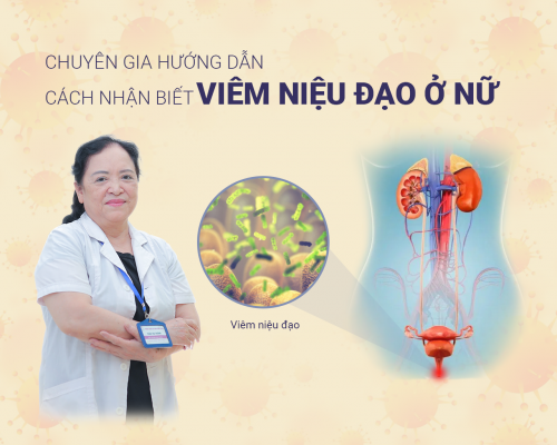 Chuyên Gia Hướng Dẫn Cách Nhận Biết Bệnh Viêm Niệu Đạo Ở Nữ Giới