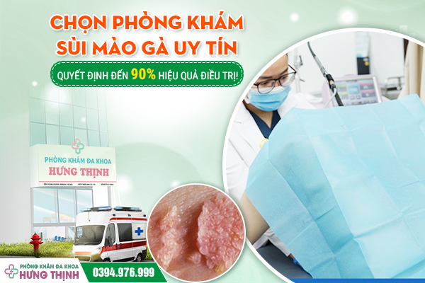 Chọn Phòng Khám Sùi Mào Gà Uy Tín – Quyết Định Đến 90% Hiệu Quả Điều Trị!