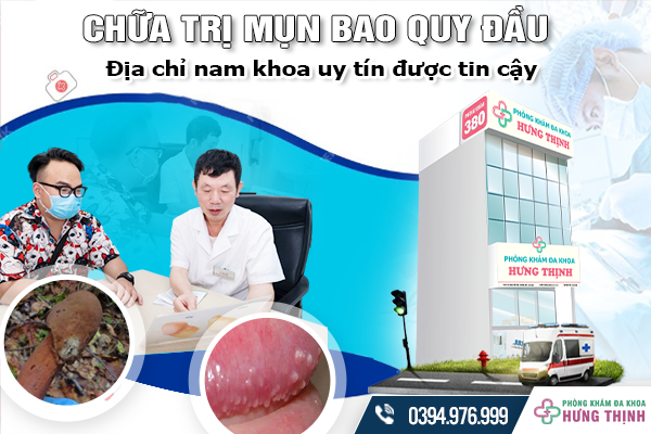 Chữa trị mụn bao quy đầu: Địa chỉ nam khoa uy tín được tin cậy