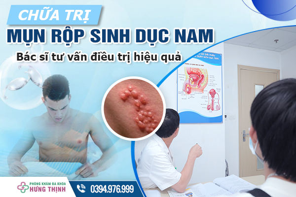 Chữa trị mụn rộp sinh dục nam giới không khó - Bác sĩ tư vấn điều trị hiệu quả