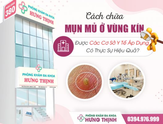 Cách Chữa Mụn Mủ Ở Vùng Kín Được Nhiều Cơ Sở Y Tế Áp Dụng Có Thực Sự Hiệu Quả?