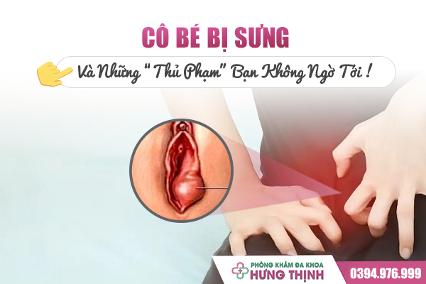 “Cô Bé” Bị Sưng Và Những “Thủ Phạm” Bạn Không Ngờ Tới
