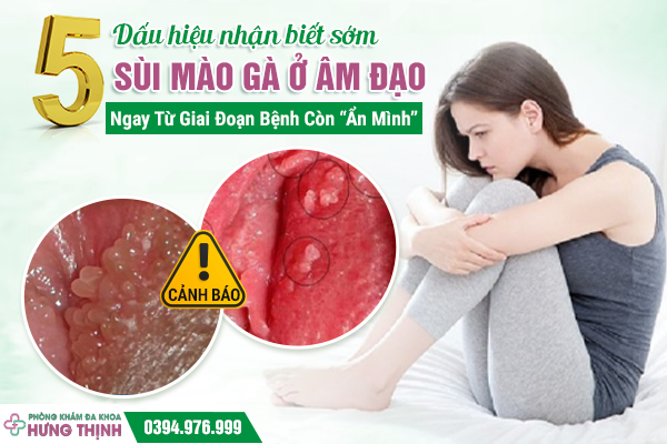 [Cảnh Báo] 5 Dấu Hiệu Nhận Biết Sớm Sùi Mào Gà Ở Âm Đạo, Ngay Từ Giai Đoạn Bệnh Còn “Ẩn Mình” 