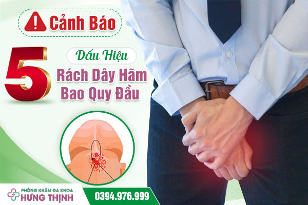 Cảnh Báo 5 Dấu Hiệu Rách Dây Hãm Bao Quy Đầu 