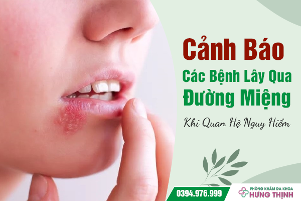 Cảnh Báo Các Bệnh Lây Qua Đường Miệng Khi Quan Hệ Nguy Hiểm