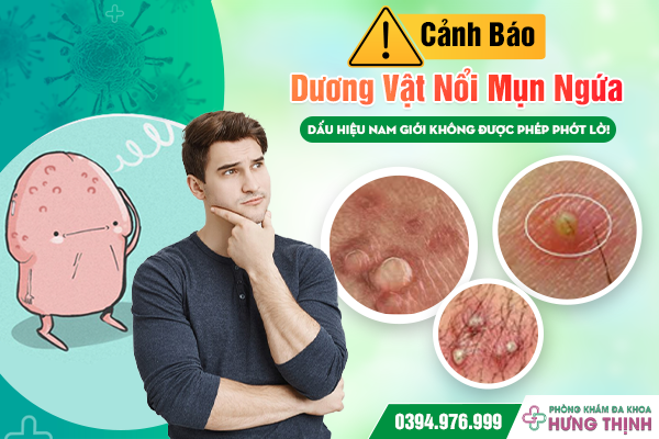 [Cảnh Báo] Dương Vật Nổi Mụn Ngứa: Dấu Hiệu Nam Giới Không Được Phép Phớt Lờ! 