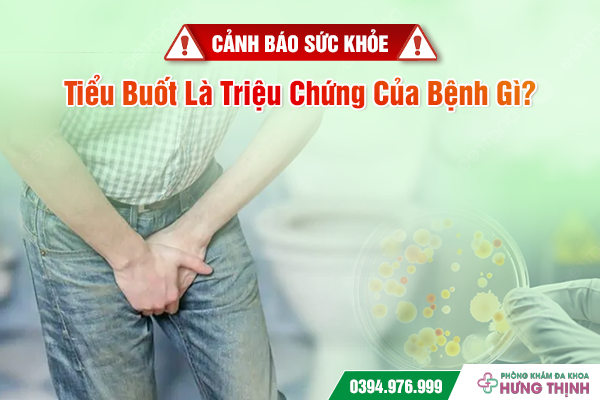 Cảnh Báo Sức Khỏe: Tiểu Buốt Là Triệu Chứng Của Bệnh Gì?