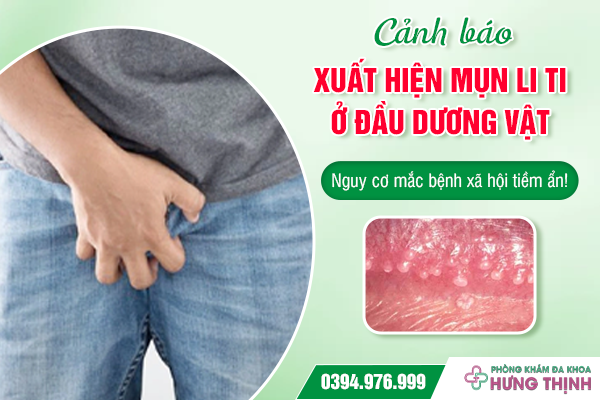 Cảnh báo: Xuất hiện mụn li ti ở đầu dương vật - Nguy cơ mắc bệnh xã hội tiềm ẩn!