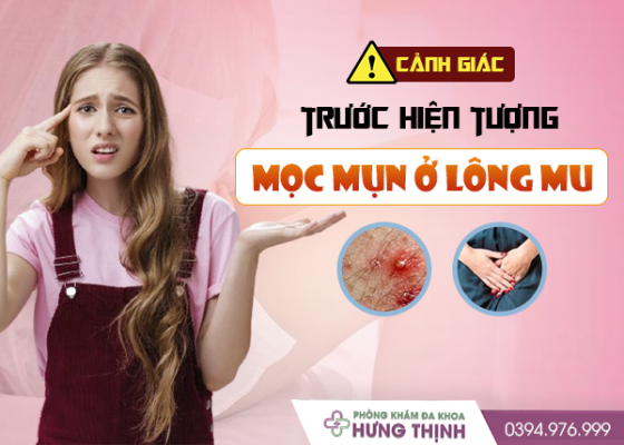 Cảnh giác trước hiện tượng mọc mụn ở lông mu nữ giới