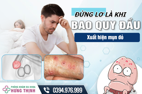 Đừng lơ là khi bao quy đầu xuất hiện mụn đỏ