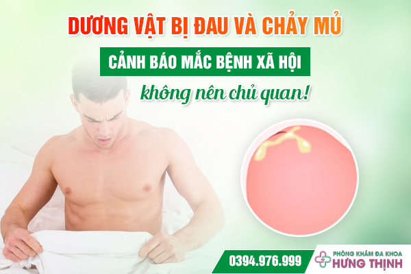 Dương vật bị đau và chảy mủ - Cảnh báo mắc bệnh xã hội không nên chủ quan!