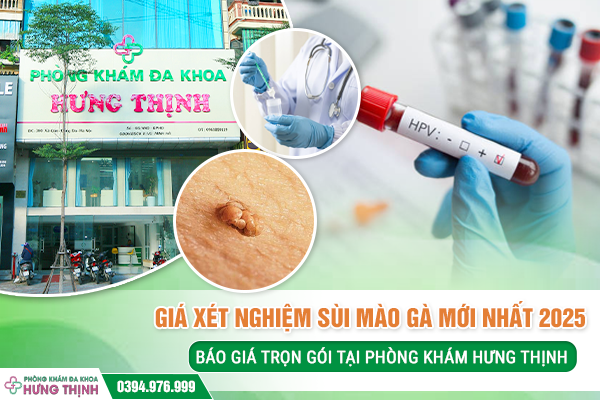 Giá Xét Nghiệm Sùi Mào Gà Mới Nhất 2025 – Báo Giá Trọn Gói Tại Phòng Khám Hưng Thịnh