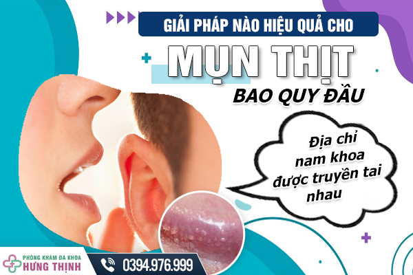 Giải pháp nào hiệu quả cho mụn thịt bao quy đầu - Địa chỉ nam khoa được truyền tai nhau