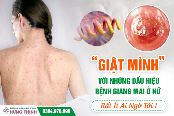 “Giật Mình” Với Những Dấu Hiệu Bệnh Giang Mai Ở Nữ: Rất Ít Ai Ngờ Tới !