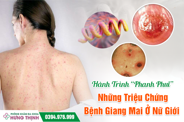 Hành Trình “Phanh Phui” Những Triệu Chứng Bệnh Giang Mai Ở Nữ Giới 