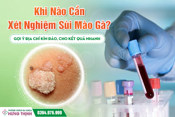 Khi Nào Cần Xét Nghiệm Sùi Mào Gà? Gợi Ý Địa Chỉ Kín Đáo, Cho Kết Quả Nhanh 