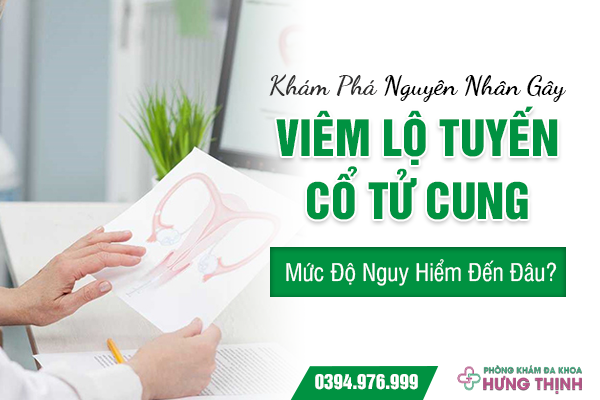 Khám Phá Nguyên Nhân Gây Viêm Lộ Tuyến Cổ Tử Cung: Mức Độ Nguy Hiểm Đến Đâu?