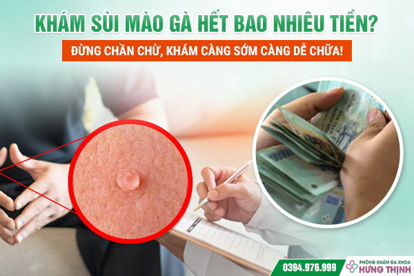 Khám Sùi Mào Gà Hết Bao Nhiêu Tiền? Đừng Chần Chừ, Khám Càng Sớm Càng Dễ Chữa!