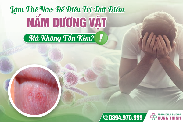 Làm Thế Nào Để Điều Trị Dứt Điểm Nấm Dương Vật, Mà Không Tốn Kém?
