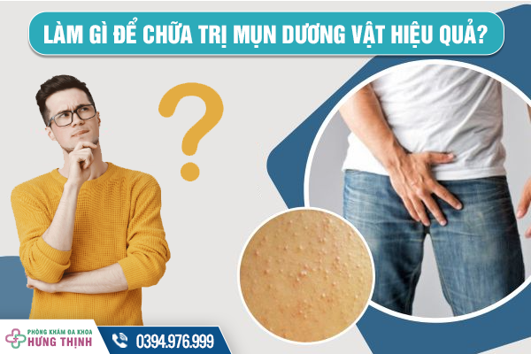 Làm gì để chữa trị mụn dương vật hiệu quả?