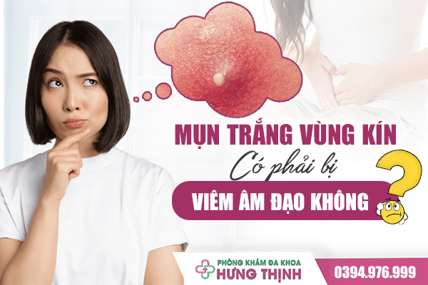 Mụn Trắng Ở Vùng Kín Nữ Giới Có Phải Là Dấu Hiệu Của Viêm Âm Đạo Không?