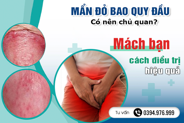 Mẩn đỏ bao quy đầu có nên chủ quan? Mách bạn những cách điều trị hiệu quả