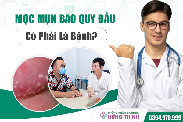 Mọc Mụn Bao Quy Đầu Có Phải Là Bệnh? Cảnh Báo Nguy Cơ Tiềm Ẩn Không Thể Lơ Là