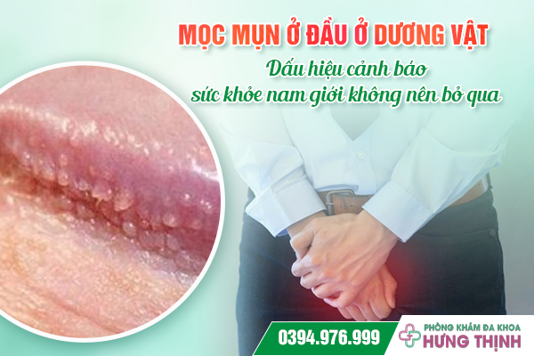 Mọc mụn ở đầu dương vật: Dấu hiệu cảnh báo sức khỏe nam giới không nên bỏ qua