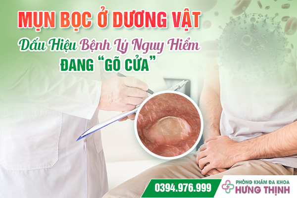 Mụn Bọc Ở Dương Vật: Dấu Hiệu Bệnh Lý Nguy Hiểm Đang “Gõ Cửa”