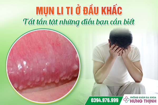 Mụn li ti ở đầu khấc: Tất tần tật những điều bạn cần biết