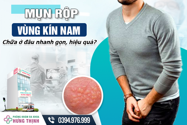 Mụn rộp vùng kín nam: Chữa ở đâu nhanh gọn, hiệu quả?