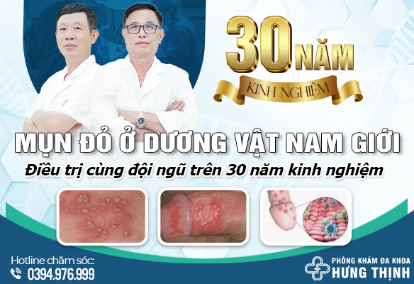 Mụn đỏ ở dương vật nam giới có đáng lo không? Điều trị cùng đội ngũ trên 30 năm kinh nghiệm