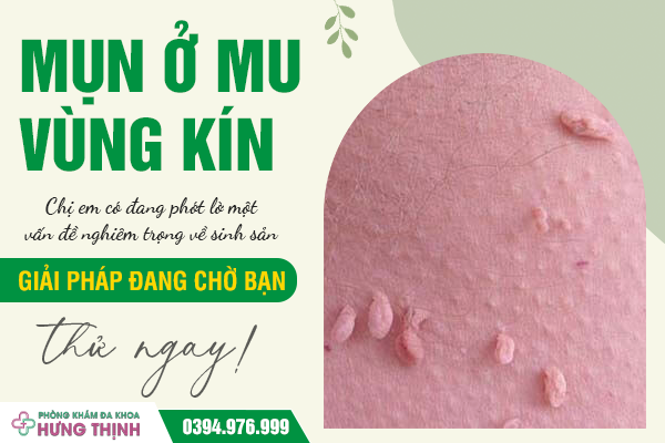 Mụn ở mu vùng kín: Chị em có đang phớt lờ một vấn đề nghiêm trọng về sinh sản. Giải pháp đang chờ bạn, thử ngay!