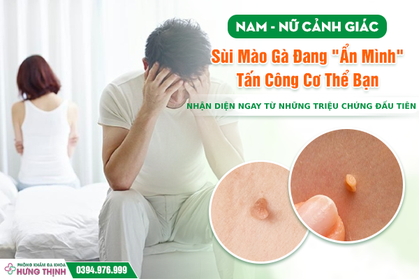 Nam – Nữ Cảnh Giác: Sùi Mào Gà Đang 