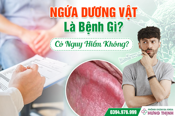 Ngứa Dương Vật Là Bệnh Gì? Có Nguy Hiểm Không?