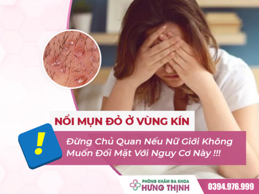 Nổi Mụn Đỏ Ở Vùng Kín - Đừng Chủ Quan Nếu Nữ Giới Không Muốn Đối Mặt Với Nguy Cơ Này