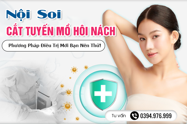 Nội Soi Cắt Tuyến Mồ Hôi Nách - Phương Pháp Điều Trị Mới Bạn Nên Thử!