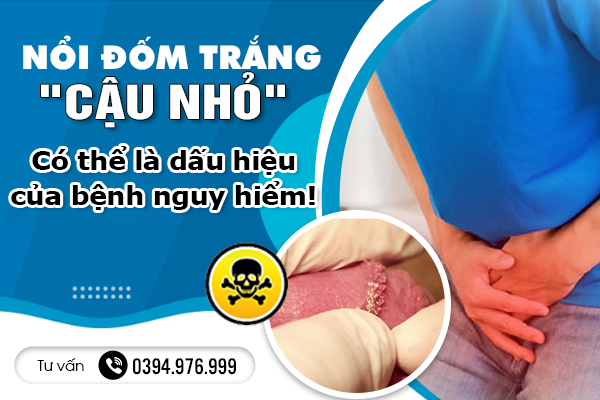 Cảnh báo: Nổi đốm trắng ở 