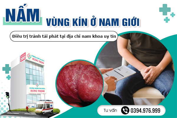 Nấm vùng kín ở nam giới: Điều trị tránh tái phát tại địa chỉ nam khoa uy tín